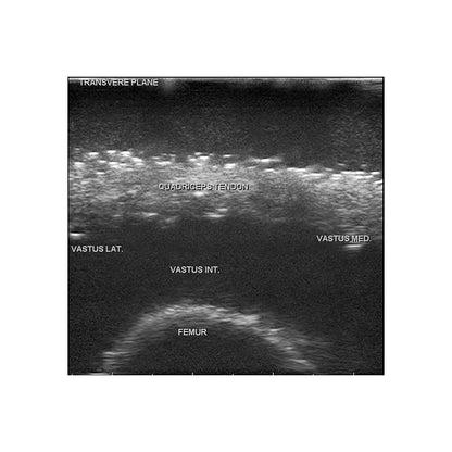 Blue Phantom MSK Knee Ultrasound Training Model