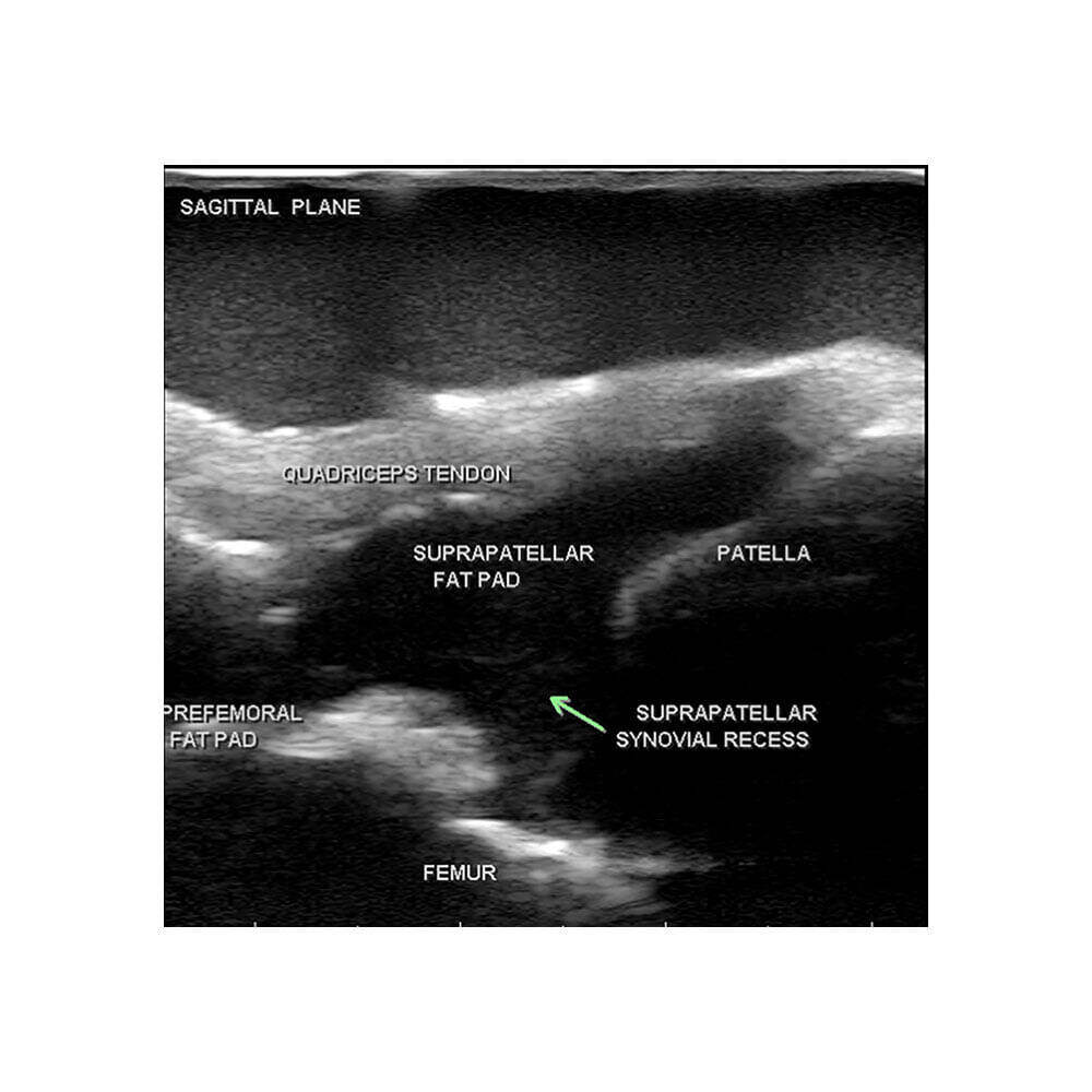 Blue Phantom MSK Knee Ultrasound Training Model