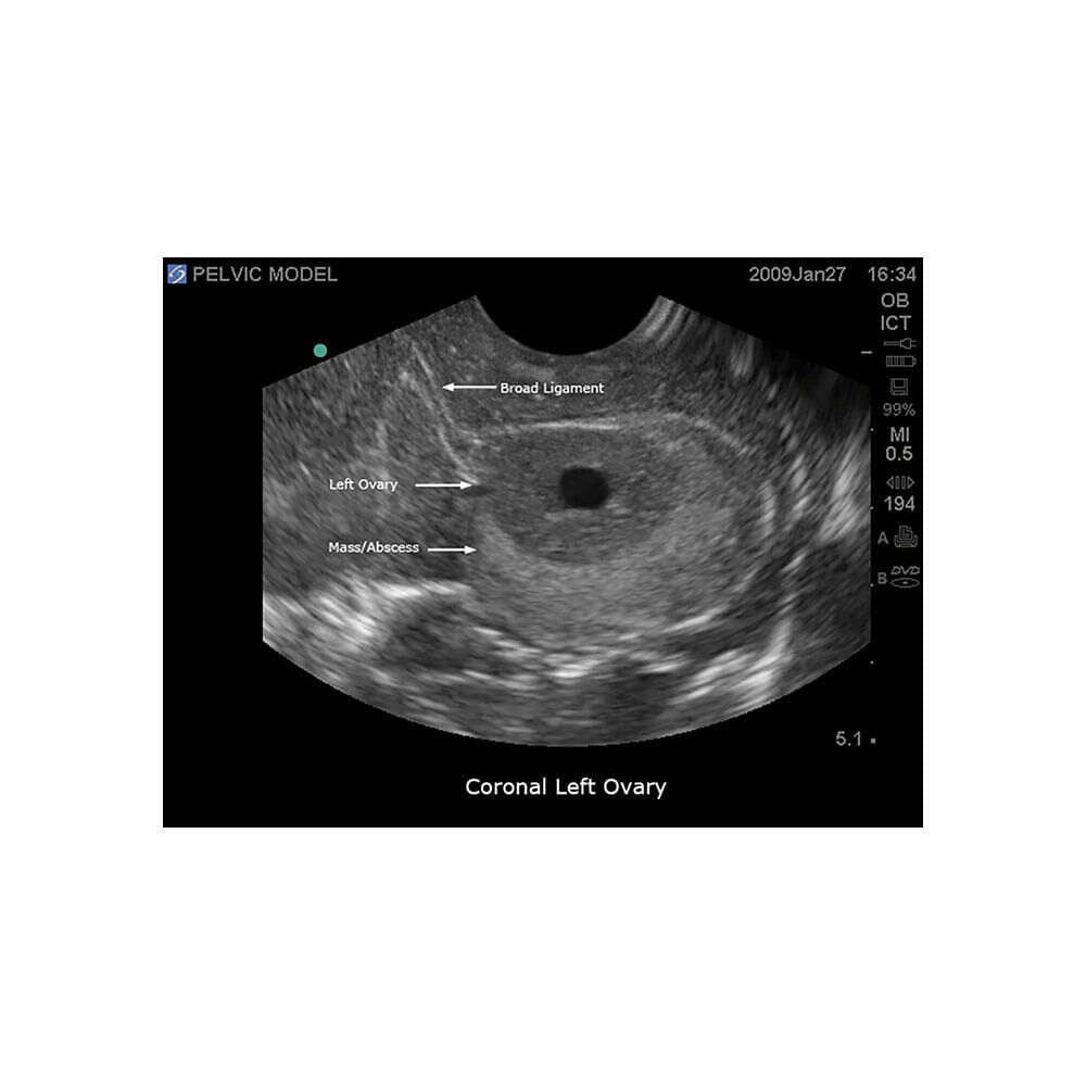 Blue Phantom Transvaginal Ultrasound Training Model