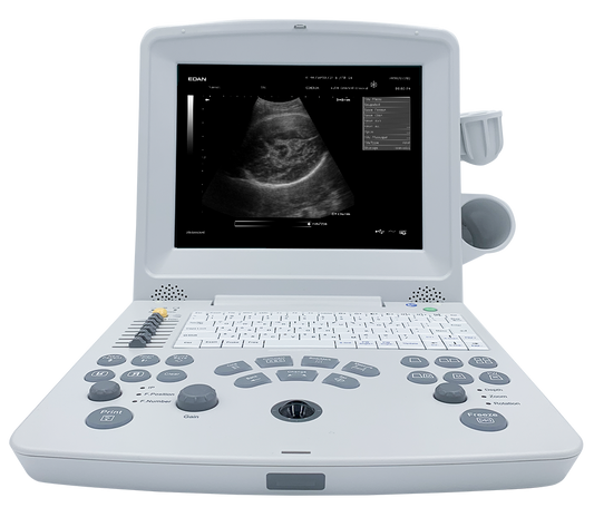 DUS60 Black and White Ultrasound