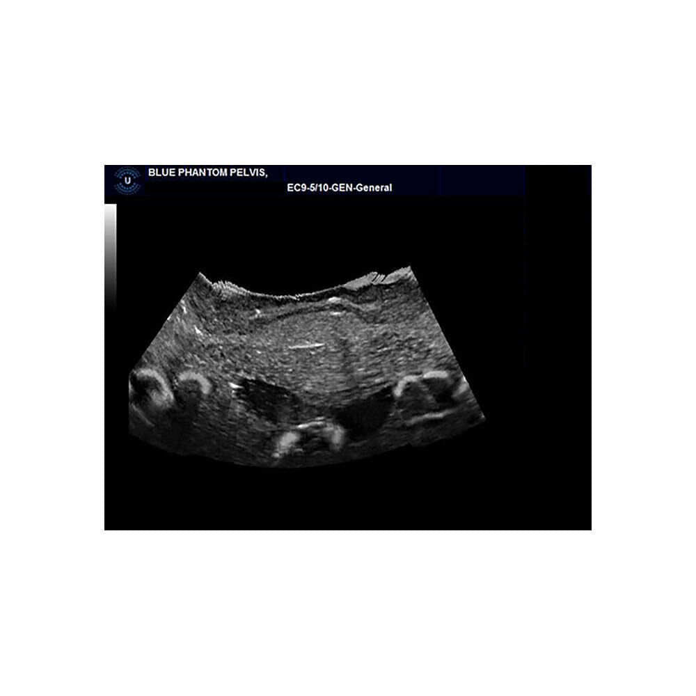 Blue Phantom Transvaginal Ultrasound Training Model