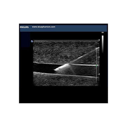 Blue Phantom Paracentesis Ultrasound Training Model