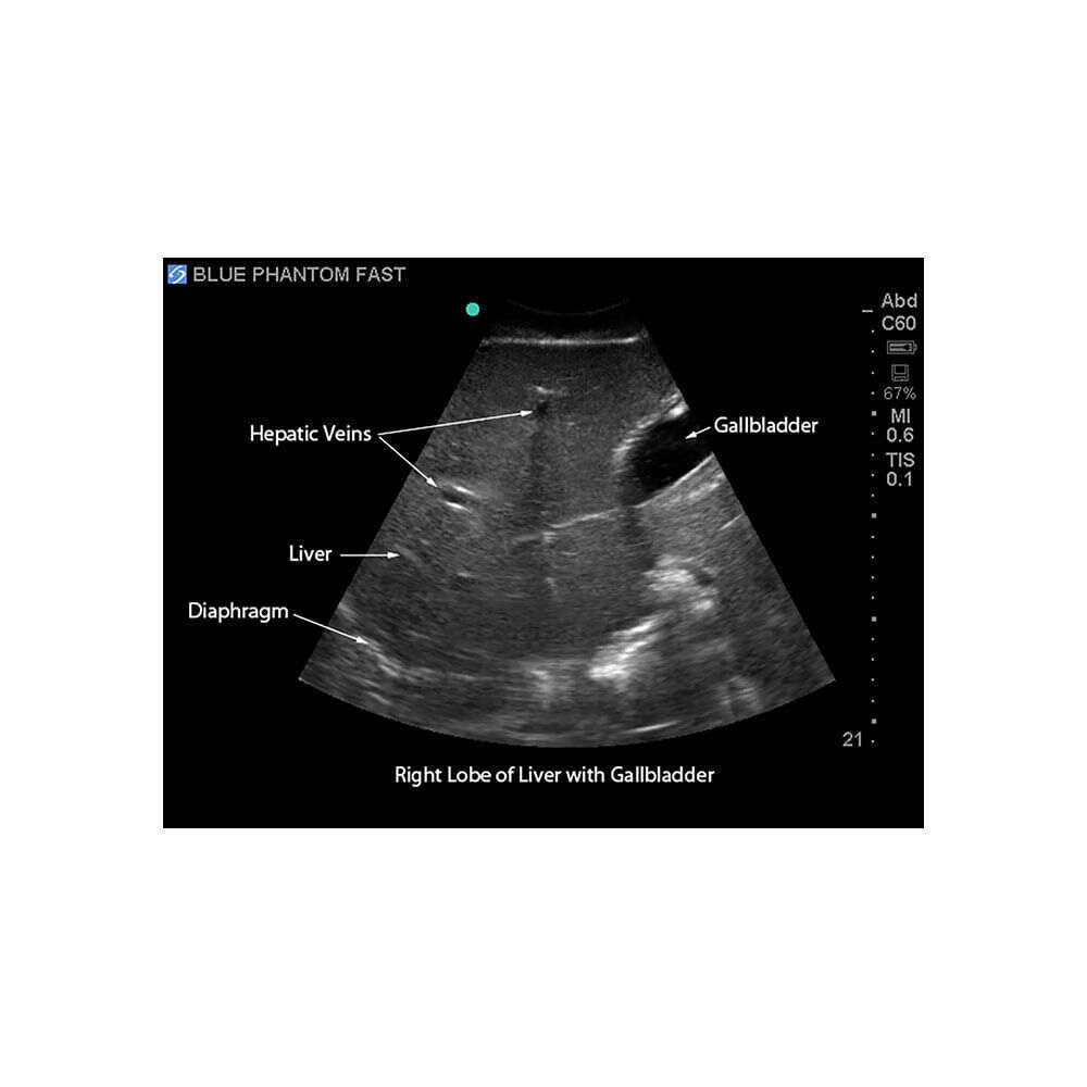 Blue Phantom FAST Exam Ultrasound Training Model