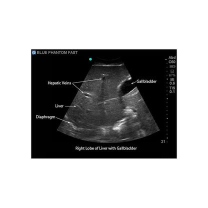 Blue Phantom FAST Exam Ultrasound Training Model