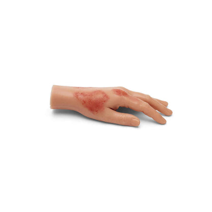 Medicor Small Adult Burned Hand