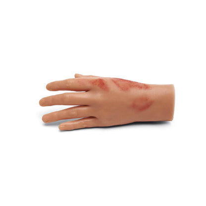 Medicor Small Adult Burned Hand