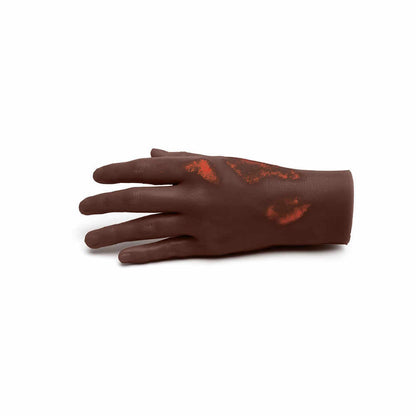 Medicor Small Adult Burned Hand