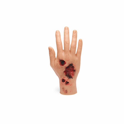 Medicor Large Adult Burned Hand