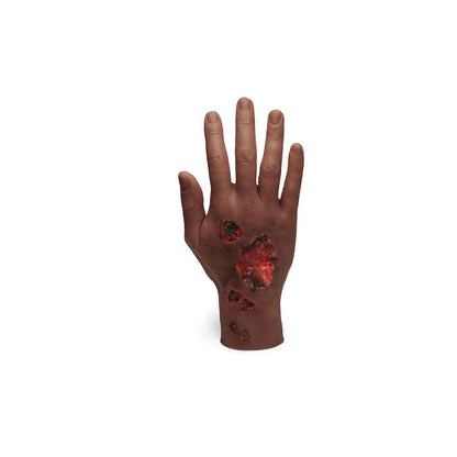 Medicor Large Adult Burned Hand