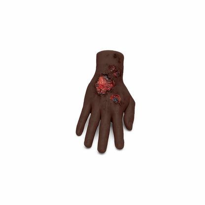 Medicor Large Adult Burned Hand