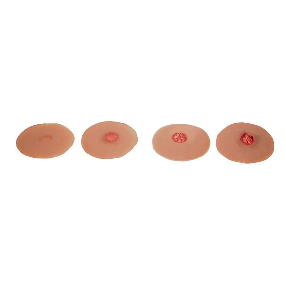 Medicor Pressure Ulcer Sticky Wound Kit