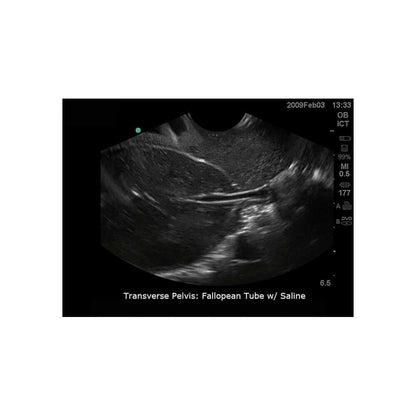 Blue Phantom Transvaginal Ultrasound Training Model