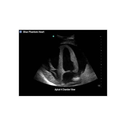 Blue Phantom Cardiac Ultrasound Training Block