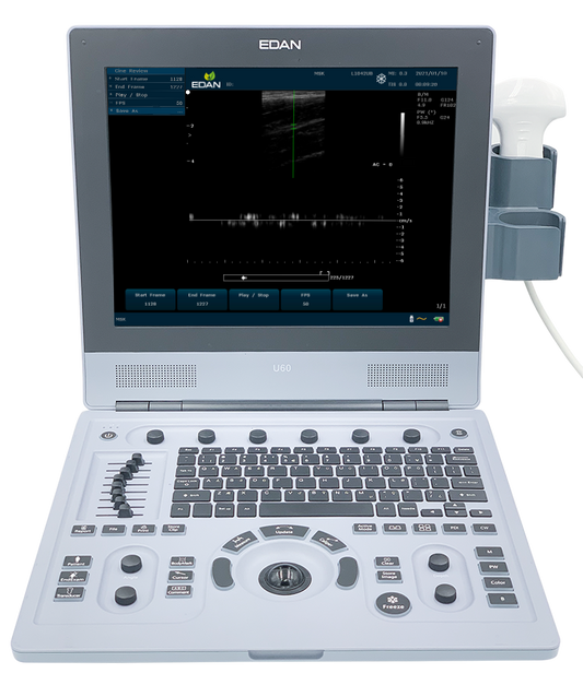 U60 Color Ultrasound