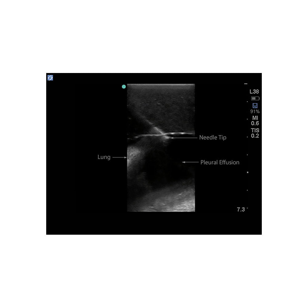 Blue Phantom Midscapular Thoracentesis Ultrasound Training Model