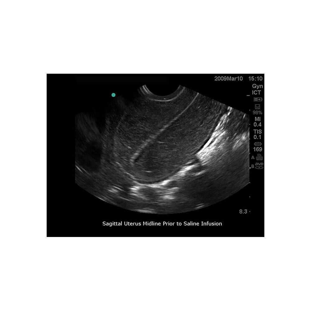 Blue Phantom Transvaginal Ultrasound Training Model