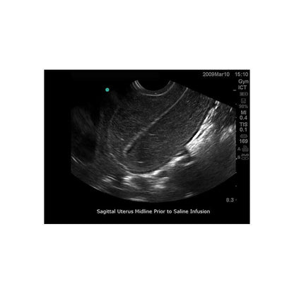 Blue Phantom Transvaginal Ultrasound Training Model