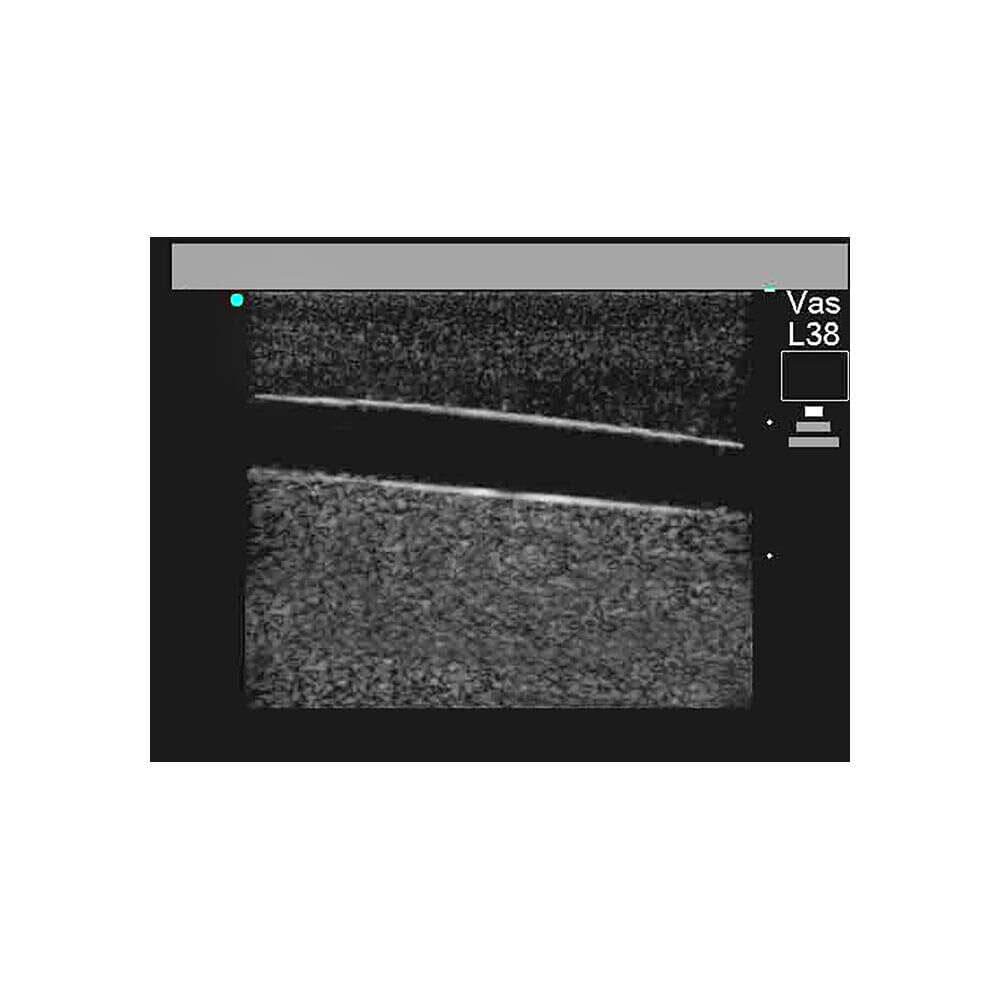 Blue Phantom Paracentesis Replacement Insert