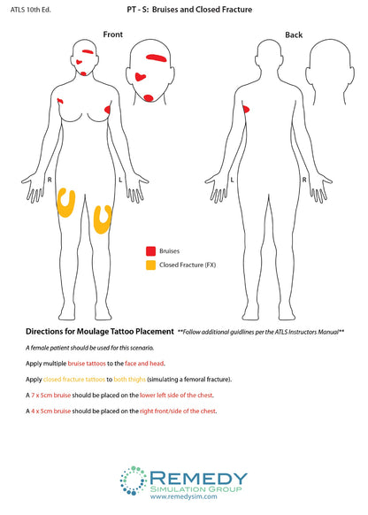 Moulage Tattoo Patient S Scenario