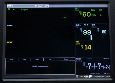 X10 Patient monitor with 10'' touch screen and Wi-Fi