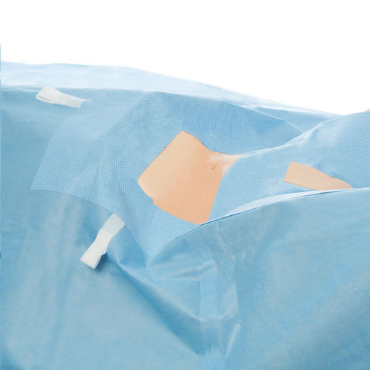 Laparoscopy Drapes