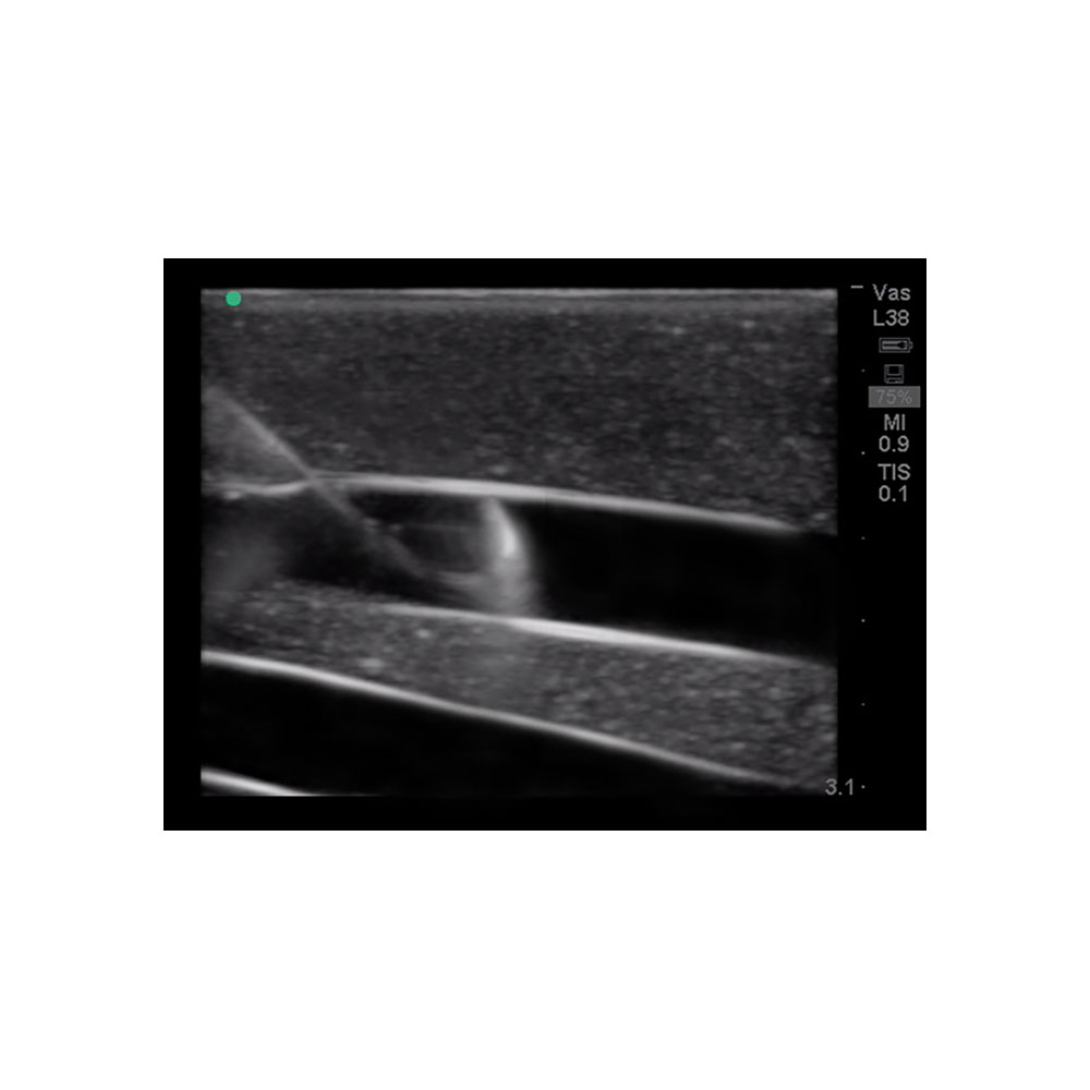 Blue Phantom Central Line and Regional Anesthesia Ultrasound Training Models