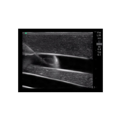 Blue Phantom Central Line and Regional Anesthesia Ultrasound Training Models