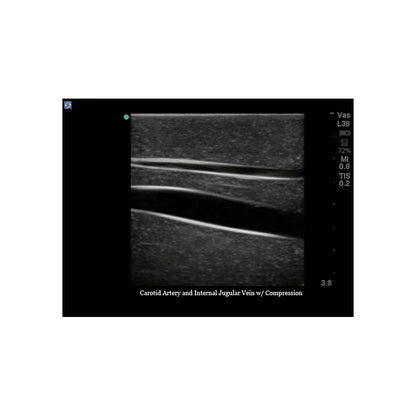 Blue Phantom Central Line and Regional Anesthesia Ultrasound Training Models