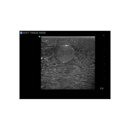 Blue Phantom Soft Tissue Masses Ultrasound Training Model, Leg