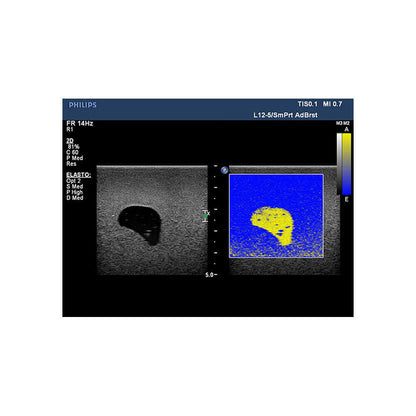 Blue Phantom Breast Ultrasound Training Model