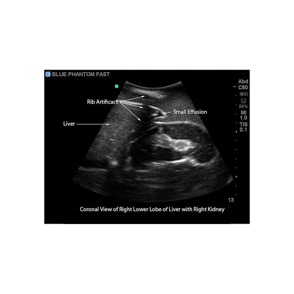 Blue Phantom FAST Exam Ultrasound Training Model