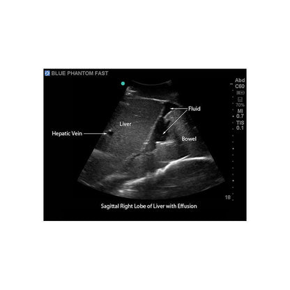 Blue Phantom FAST Exam Ultrasound Training Model