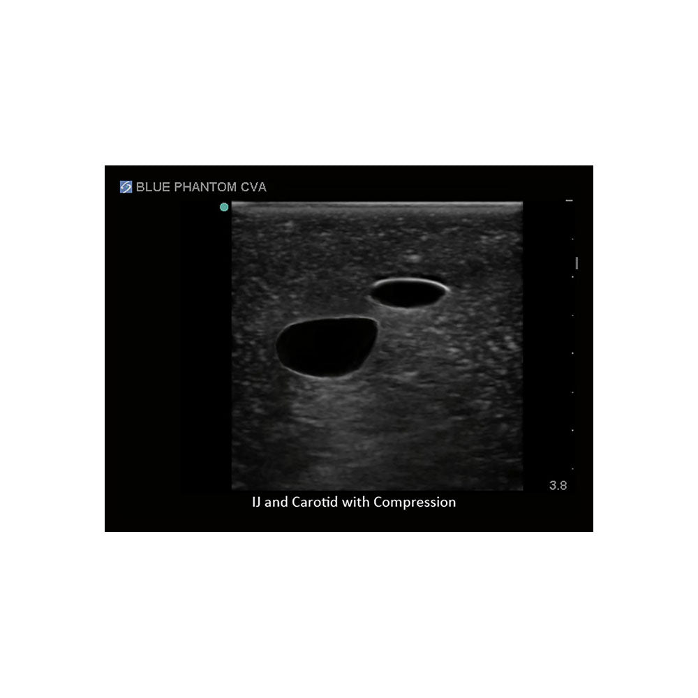 Blue Phantom Central Line and Regional Anesthesia Ultrasound Training Models