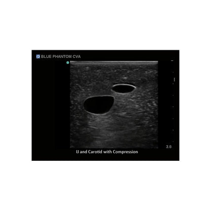 Blue Phantom Central Line and Regional Anesthesia Ultrasound Training Models