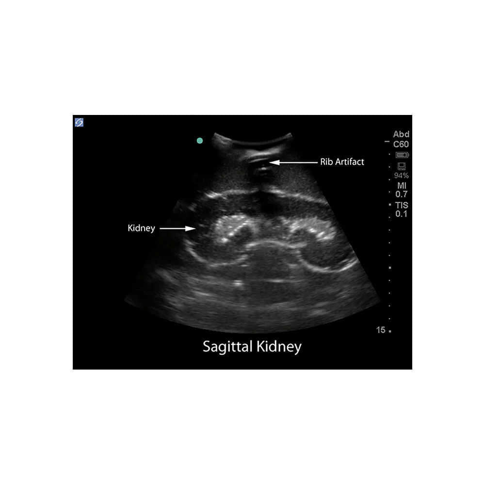 Blue Phantom Renal Biopsy Ultrasound Training Model