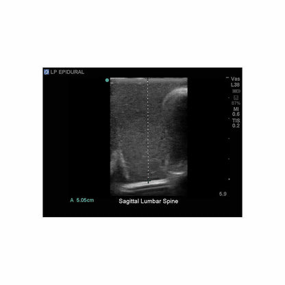 Blue Phantom Epidural Ultrasound Training Model