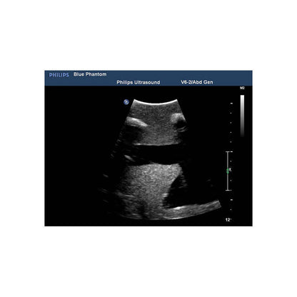 Blue Phantom Thoracentesis and Thoracostomy Ultrasound Training Model