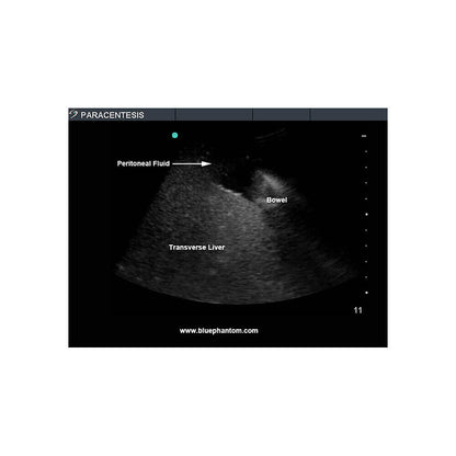 Blue Phantom Paracentesis Replacement Insert