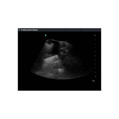 Blue Phantom Paracentesis Ultrasound Training Model