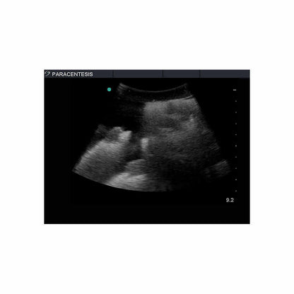 Blue Phantom Paracentesis Ultrasound Training Model