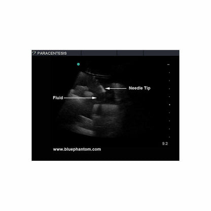 Blue Phantom Paracentesis Ultrasound Training Model