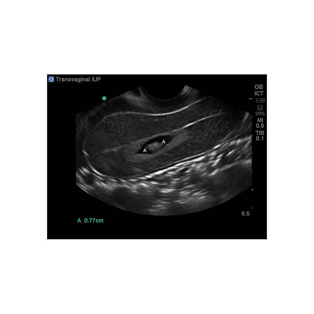 Blue Phantom Transvaginal Ultrasound Training Model