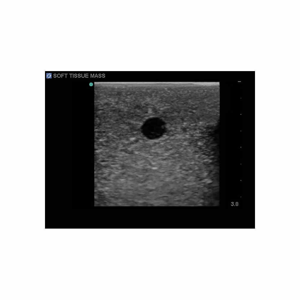 Blue Phantom Soft Tissue Masses Ultrasound Training Model, Leg