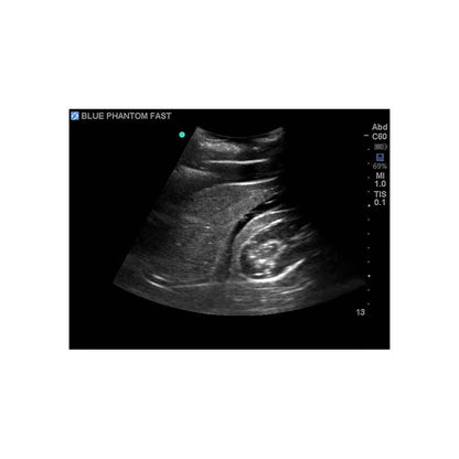 Blue Phantom FAST Exam Ultrasound Training Model