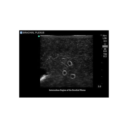 Blue Phantom Central Line and Regional Anesthesia Ultrasound Training Models