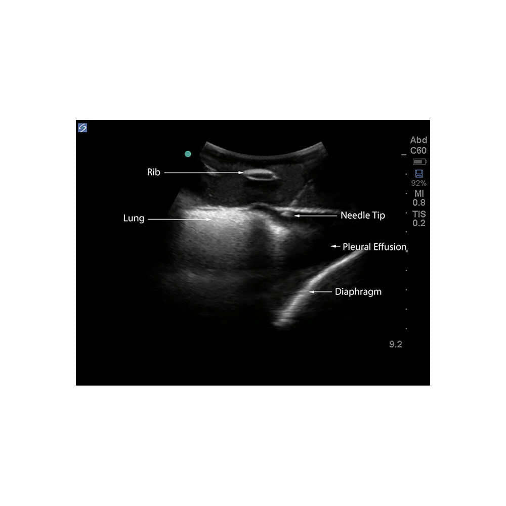 Blue Phantom Midscapular Thoracentesis Ultrasound Training Model