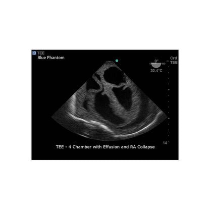 Blue Phantom Cardiac Ultrasound Training Block