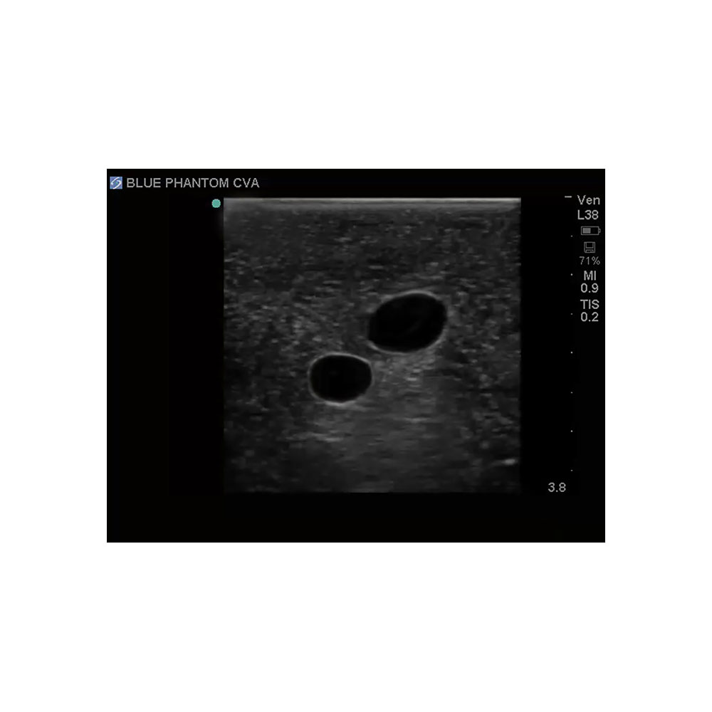 Blue Phantom Central Line and Regional Anesthesia Ultrasound Training Models