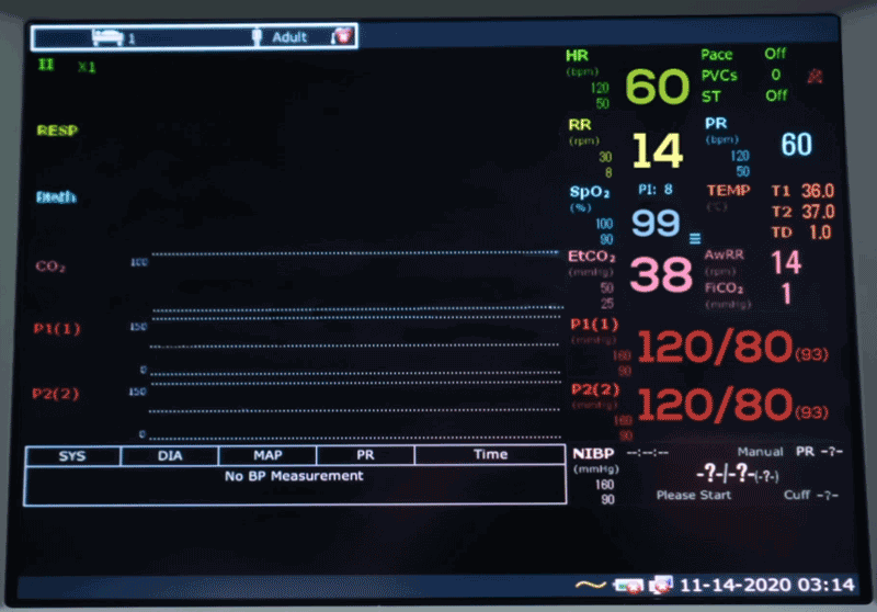 iM50 Patient monitor with 8.4'' screen