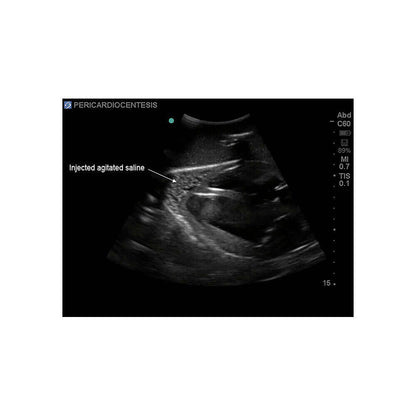 Blue Phantom Cardiac Ultrasound Training Block